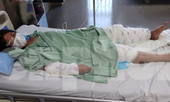 Chồng say rượu, tẩm xăng thiêu sống vợ