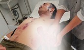 Tự chế mìn đánh cá, 7 người bị thương