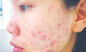 Sát Tết, lại khổ vì mỹ phẩm giả