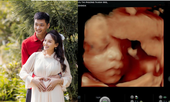 Bảo Thanh hạnh phúc lần đầu khoe ảnh siêu âm con gái sắp chào đời