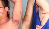 Hai mẹ con bị chém gục khi nhắc nhở hàng xóm xây lấn vỉa hè