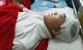 Nam sinh lớp 11 đánh bạn vỡ sọ não bị bắt tạm giam