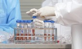 Đại hội XIII của Đảng: Phóng viên tác nghiệp sẽ được xét nghiệm SARS-CoV-2