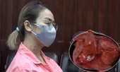 Cố nịt bụng vì sợ bị chê mập, không ngờ mang khối u tụy lớn nhất thế giới