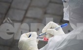 Nữ sinh ở TP Hải Dương nghi dương tính SARS-CoV-2 từng đi đâu?