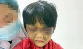 Điều tra vụ bé gái 6 tuổi ở Hải Dương bị mẹ bạo hành phải nhập viện