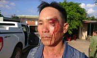 Ông Hôm bị đánh trọng thương ngay sau khi cung cấp thông tin cho báo chí