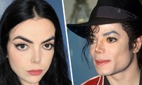 Sửng sốt với cô gái có khuôn mặt giống Michael Jackson