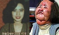  Bi kịch ‘thảm họa thẩm mỹ’ Hàn Quốc: Từ mỹ nhân hóa &apos;quái vật&apos; 