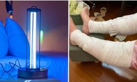 Một người Đài Loan bị bỏng nặng vì bật đèn UV diệt khuẩn trong phòng suốt 3 tiếng