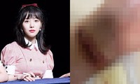Nữ idol Hàn Quốc rạch tay tự tử gây sốc, bất ngờ nhắc đến Sulli