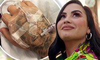 Demi Lovato 3 lần suýt chết, tổn thương não do nghiện ma túy