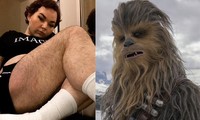 Cô gái mọc lông khắp cơ thể bị trêu chọc là Chewbacca trong phim ‘Star Wars’