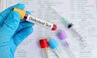 Báo động người Việt Nam thừa Cholesterol