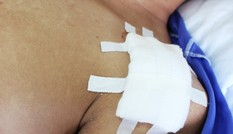 Nam sinh lớp 12 tố bị bạn cùng lớp đâm trước cổng trường