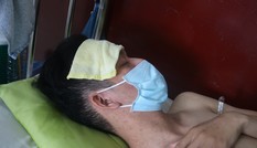 Sởi bùng phát tại TPHCM: Người lớn, trẻ nhỏ ùn ùn nhập viện