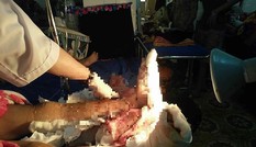Một thanh niên bị chém đứt lìa hai chân