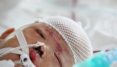 Bé gái hai tuổi bị xe tải đâm đang hồi phục