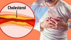 Vì sao Nattokinase Jintan hỗ trợ ‘hạ mỡ máu, ngăn tai biến’ hiệu quả