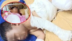 Bắt nhóm đối tượng phóng hỏa khiến 2 bé trai bỏng nặng