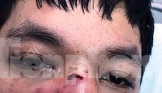 Ngang nhiên xông vào cơ quan làm việc hành hung nhân viên bảo vệ rừng