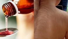 Bị cho uống nhầm thuốc mọc tóc thay vì thuốc dạ dày, 20 trẻ em “như biến thành người sói“