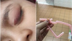 Người mẹ vô ý làm rơi mảnh mắc áo gãy, tai nạn bất ngờ đã xảy ra với cô con gái nhỏ