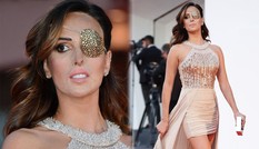 Bi kịch của nữ ca sĩ bịt một mắt lên thảm đỏ LHP Venice