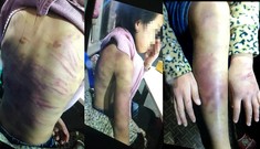 Bé gái 12 tuổi tố bị mẹ bạo hành, bạn trai của mẹ xâm hại tình dục
