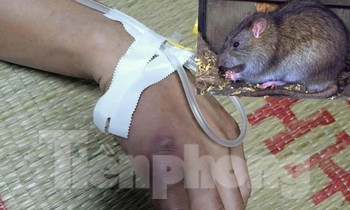 Do chủ quan không đi khám, điều trị sau khi bị chuột cắn, bệnh nhân L.H.L bị sốt cao, hạch nổi, phải điều trị, cấp cứu tích cực .Ảnh: TL
