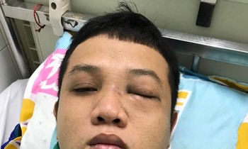 Chào hỏi trong quán nhậu, thanh niên bị 2 cán bộ CSGT đánh nhập viện