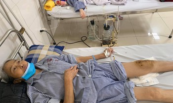 Đột phá: Lần đầu tiên thay khớp gối nhân tạo cho người mắc lao khớp gối