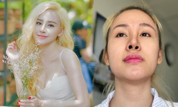 'Bà Tưng' Huyền Anh: 'Mệt mỏi với 6 năm - 4 cái mũi'