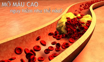 Máu nhiễm mỡ có nguy hiểm không? Cách dọn sạch mỡ máu của người Nhật