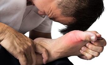 Tinh chất tiêu gout Sangu - Hướng đột phá mới trong hỗ trợ điều trị bệnh gout