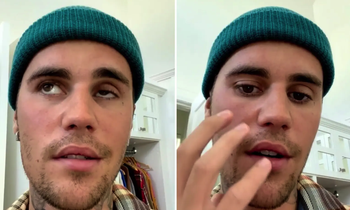 Justin Bieber bị liệt nửa mặt: Fan đứng ngồi không yên, trending hashtag mong idol mau khỏe