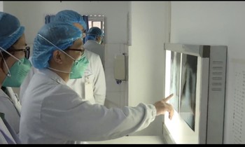 Bác sĩ kiểm tra phim X-quang bệnh nhân viêm phổi ở Vũ Hán. Ảnh: Xinhua.