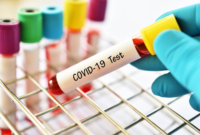Hà Nội vẫn lo ngại xuất hiện thêm ca mắc COVID-19 mới trong cộng đồng Hà Nội vẫn lo ngại xuất hiện thêm ca mắc COVID-19 mới trong cộng đồng