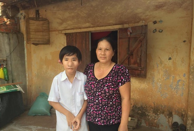 Cậu bé “Trư Bát Giới” và gần chục lần lên bàn mổ Cháu Minh Tiến và mẹ. Ảnh: Nhã Uyên