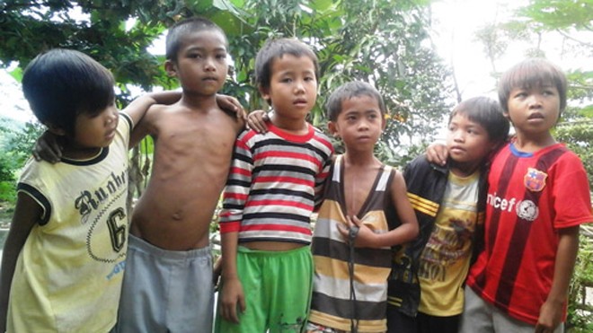 Nguy cơ suy thoái tộc người Chứt vì hôn nhân cận huyết Cậu bé Hồ Kiểng (9 tuổi, thứ ba từ phải sang) chỉ vào ngực mình cho biết đó là vết mổ tim mới được thực hiện cách đây vài tháng. Theo cán bộ xã Hương Liên thì bố mẹ Kiểng là anh em họ hàng. Ảnh: Đức Hùng