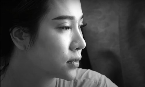 Mẹ bỉm sữa trầm cảm vì viêm da cơ địa Chị Nhật lo lắng trước tình trạng viêm da cơ địa không được cải thiện