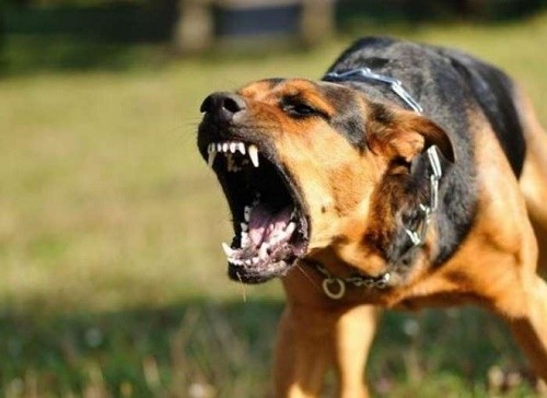 Bé trai bị chó cắn nham nhở, khâu gần 70 mũi Bé trai bị chó cắn nham nhở, khâu gần 70 mũi