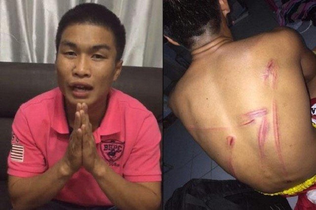 Võ sĩ Muay Thái tố bị sư phụ đánh đập, giam lỏng Bức ảnh Nattawut tung lên mạng làm bằng chứng tố cáo bị HLV đánh đập