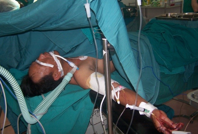 Người đàn ông bị chém rớt cánh tay xuống đất Các bác sĩ đang nối cánh tay cho anh Sửu