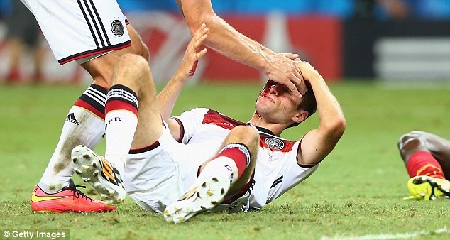 Vì sao Muller rời sân với khuôn mặt bê bết máu? Muller nằm sân với những vết máu loang lổ trên mặt
