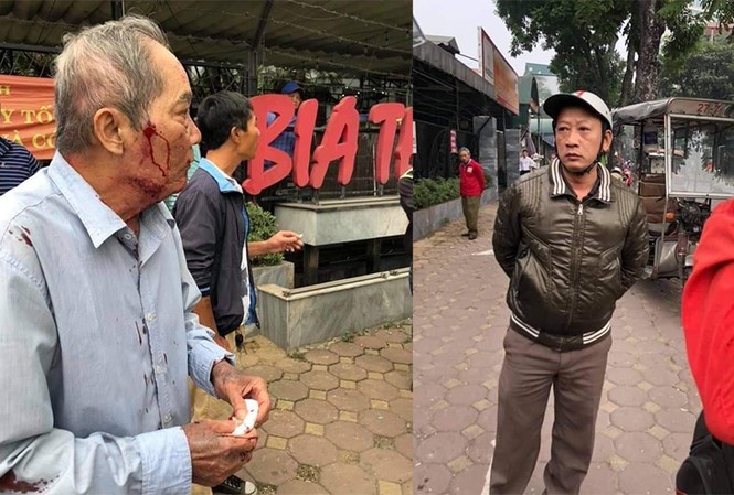 Công an điều tra vụ cụ ông 80 tuổi bị tài xế xe ôm đánh gãy xương sườn Nạn nhân và nghi can vụ án