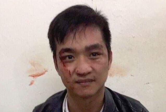 Gã trai táo tợn vào tiệm vàng giật nhẫn và dây chuyền rồi bỏ chạy Đối tượng Hải bị bắt giữ. Ảnh: FB Công an Hà Nội