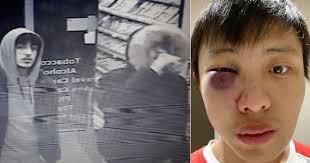 Sinh viên châu Á nghi bị tấn công ở London vì phân biệt chủng tộc dịch Covid-19 Hé lộ hình ảnh 4 thanh niên đánh du học sinh Singapore gốc Hoa