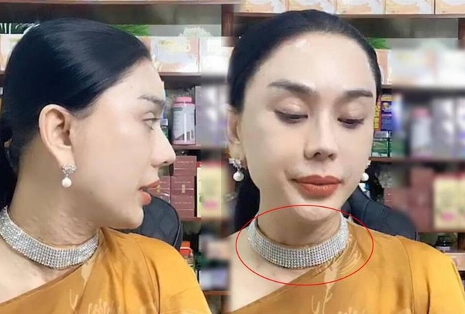 Showbiz 21/1: Lâm Khánh Chi tái xuất sau khi lộ làn da nhăn nheo, sần sùi Showbiz 21/1: Lâm Khánh Chi tái xuất sau khi lộ làn da nhăn nheo, sần sùi