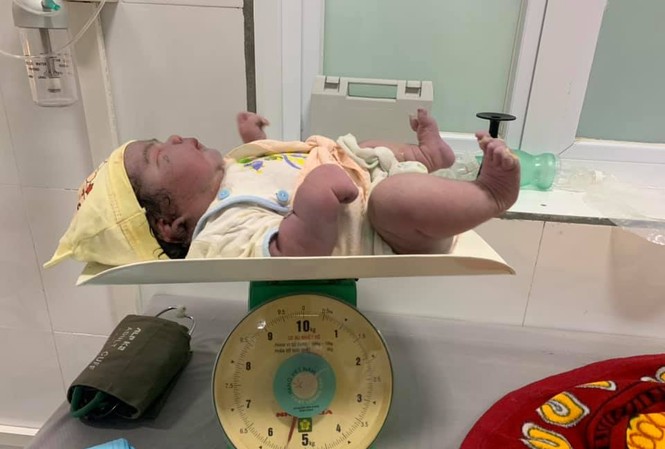 Kỳ tích sản phụ sinh thường bé gái nặng 5,5kg tại huyện miền núi Nghệ An Kỳ tích sản phụ sinh thường bé gái nặng 5,5kg tại huyện miền núi Nghệ An
